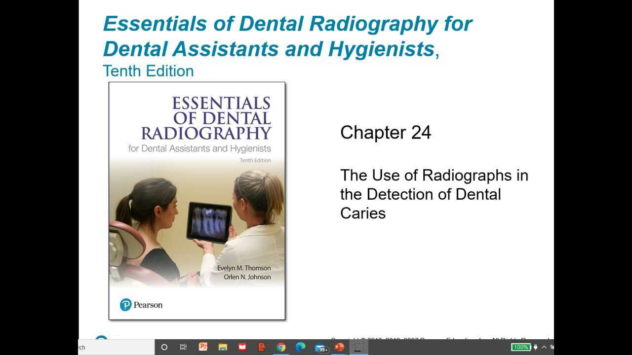 Chapter 24 The Use of Radiographs in the Detection of Dental Caries