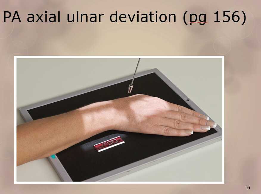 Radiography for Gaynor Hart and Forearm and Trauma positioning.